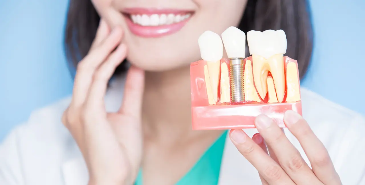 Dental Implants: A Revolutionary Solution For Tooth Loss And Its Benefits