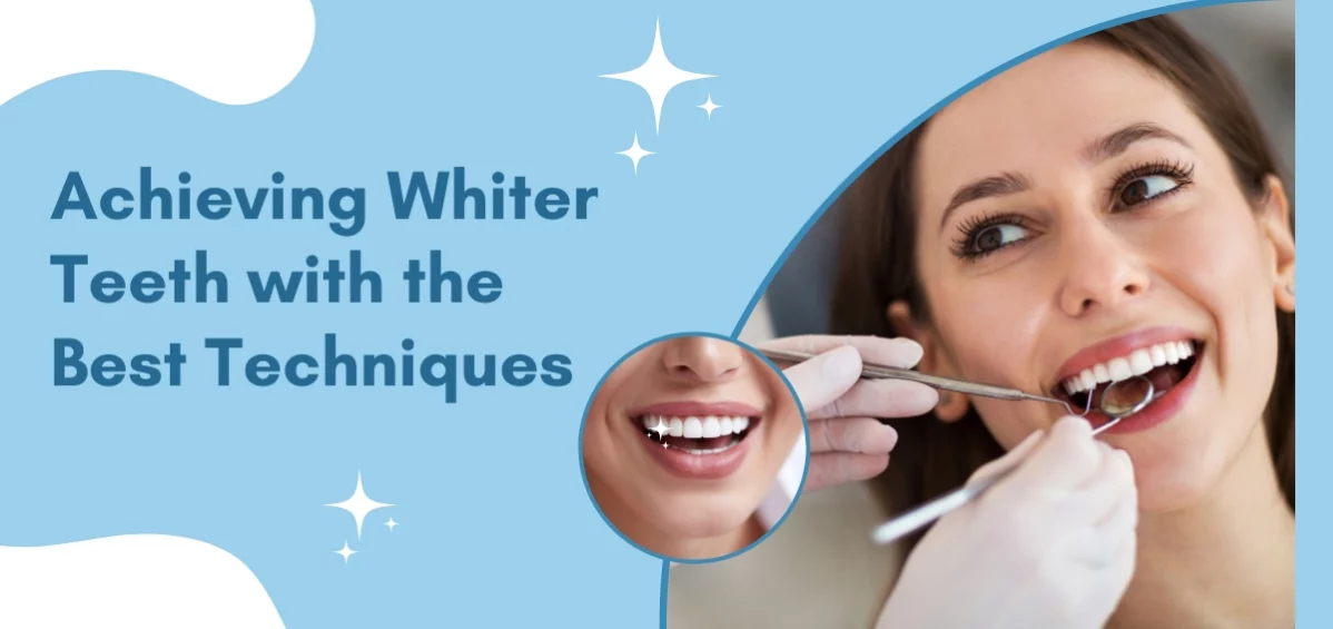 Achieving Whiter Teeth with the Best Techniques
