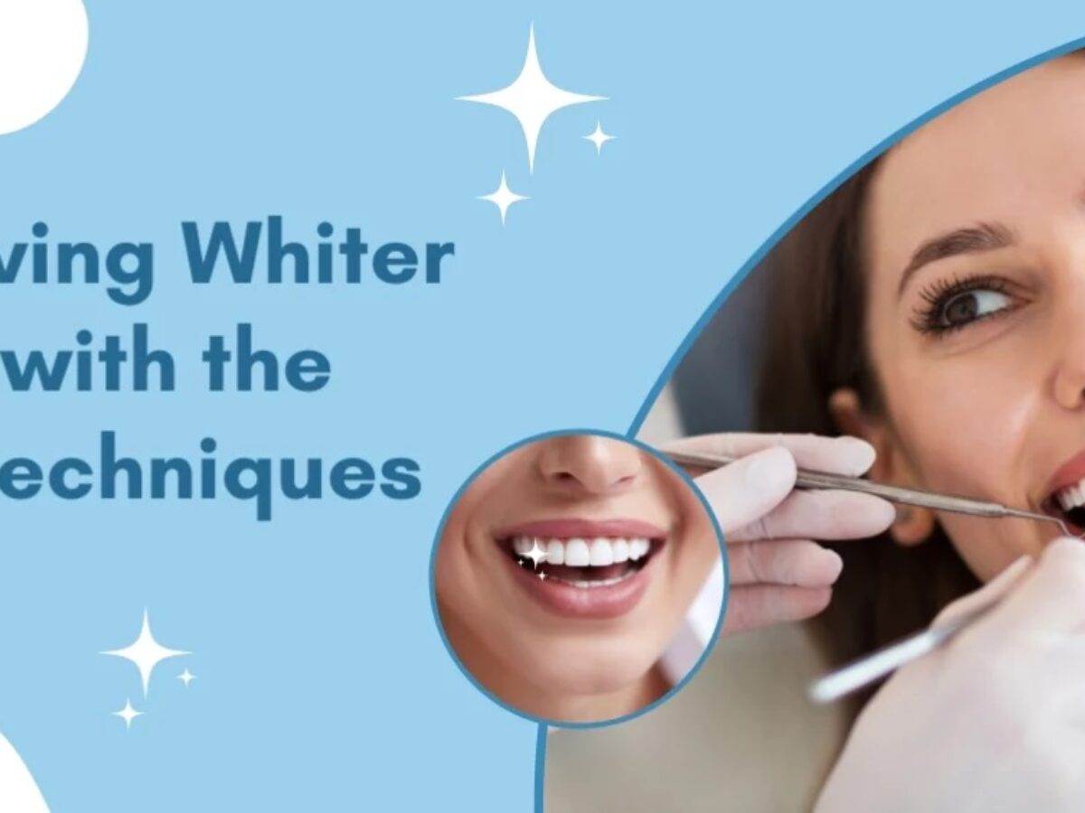 Explore Effective Teeth Whitening Techniques for a Brighter Smile