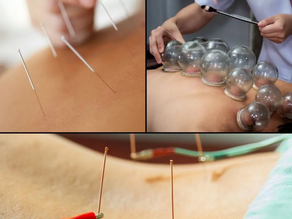 South Philly Community Acupuncture