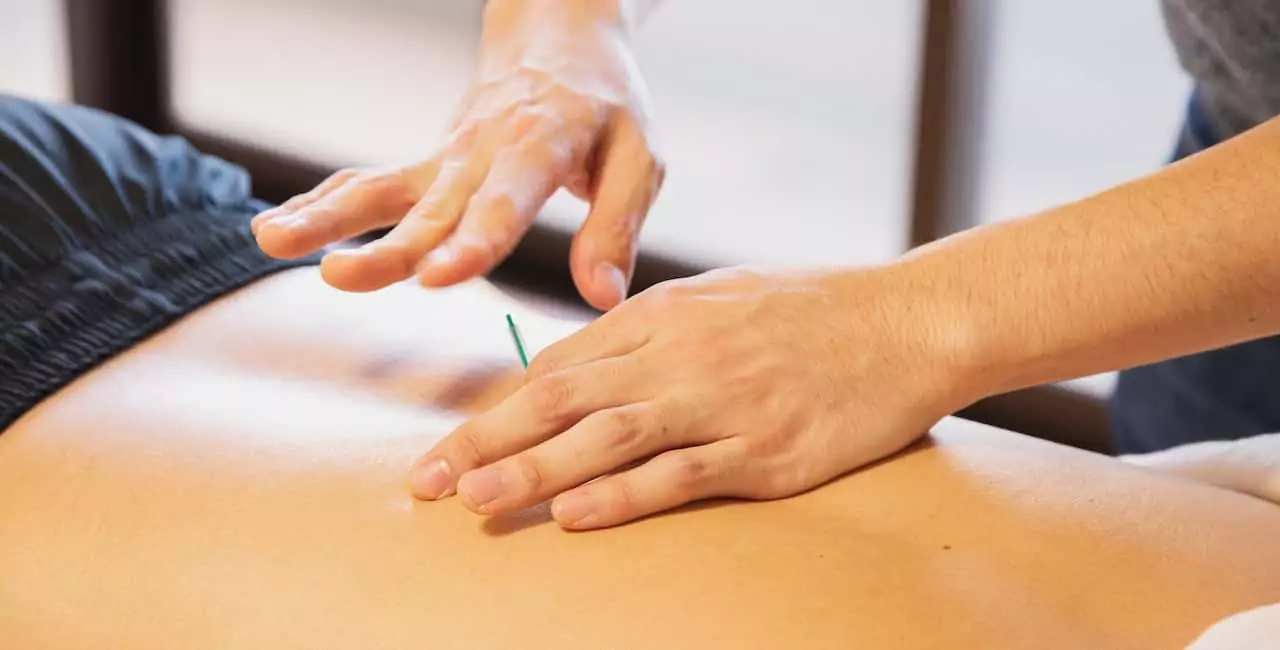 An Introduction To Dry Needling: What You Need To Know